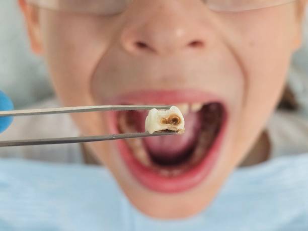 Best Emergency Dental Care for Broken or Chipped Teeth in Benavides, TX